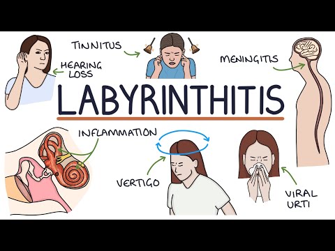 Understanding Anxiety Symptoms in Labyrinthitis Cases