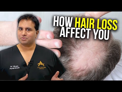 The Psychological Roots of Hair Phobia and Its Effects